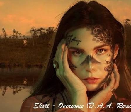 Skott – Overcome